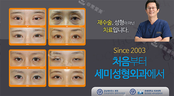 韩国世美整形照片 韩国世美整形照片