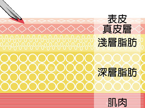 脂肪各個(gè)層次 脂肪各個(gè)層次