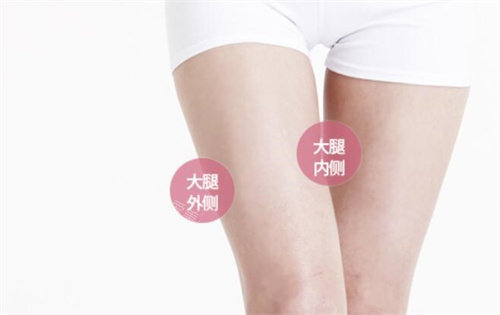 大腿吸脂部位示意图 大腿吸脂部位示意图