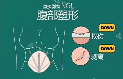 腹部整形手术优势示意图
