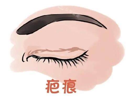 濟南韓氏整形醫(yī)院眼修復(fù)示意圖 濟南韓氏整形醫(yī)院眼修復(fù)示意圖