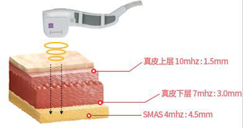 韓國秀美顏整形外科脂肪填充特點介紹