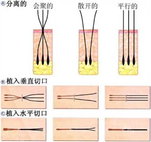 毛囊单位模式图