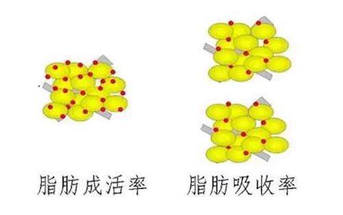 自體脂肪移植圖