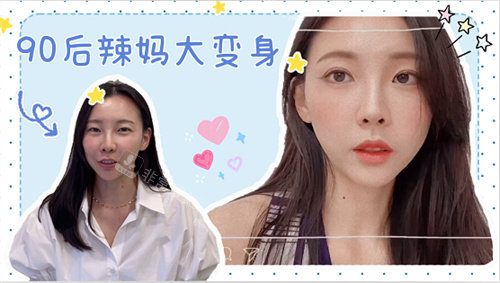韓國樂日整形眼部修復前后照片 韓國樂日整形眼部修復前后照片