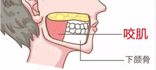 面部咬肌、下颌骨解剖示意图