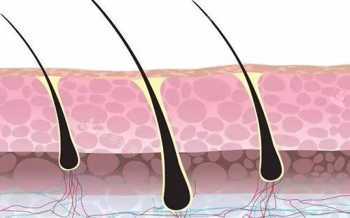 头发毛囊示意图