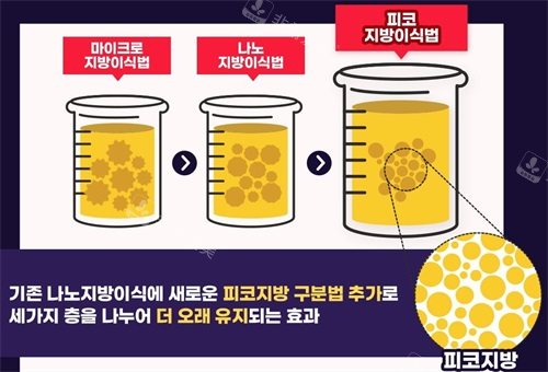 韩国绮林整形医院面部填充脂肪三个阶段