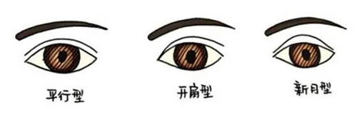 不同類型的雙眼皮 不同類型的雙眼皮