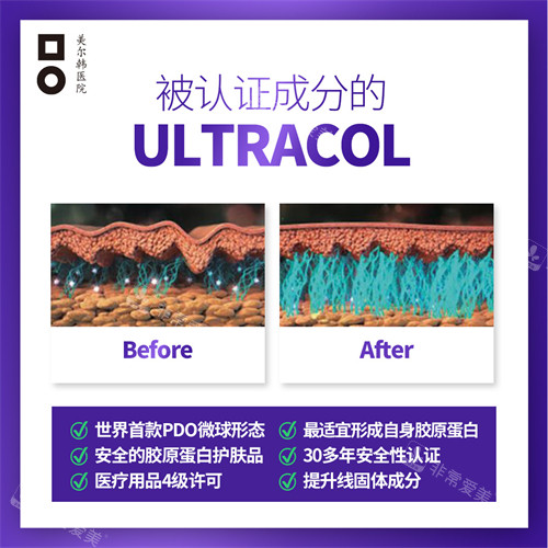 胶原蛋白提升注射ULTRACOL成分介绍图