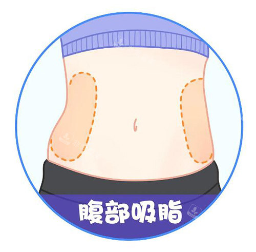 腹部吸脂卡通圖展示照片 腹部吸脂卡通圖展示照片
