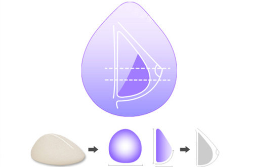 韩国德莱茵水滴形假体植入后胸部形态