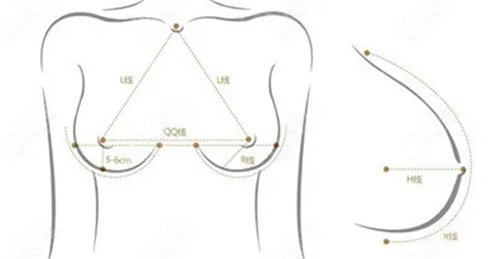 想做隆胸手术？来了解一下韩国德莱茵“水滴形丰胸术”！