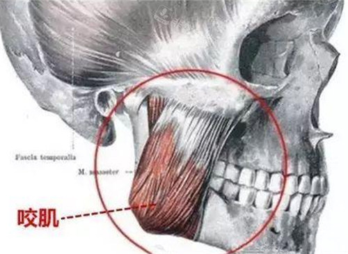 咬肌位置展示图