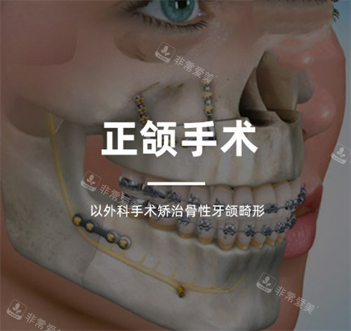 正頜手術宣傳圖 正頜手術宣傳圖