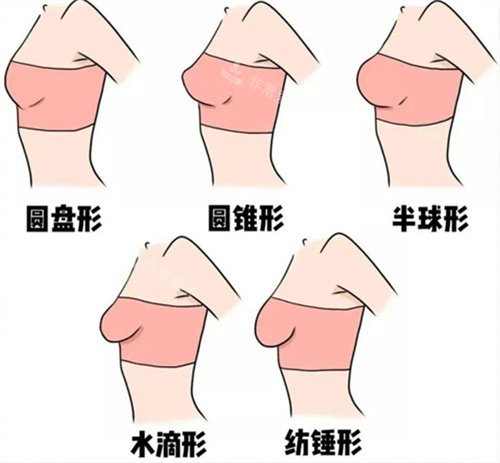 乳房的正常形态 状态图片