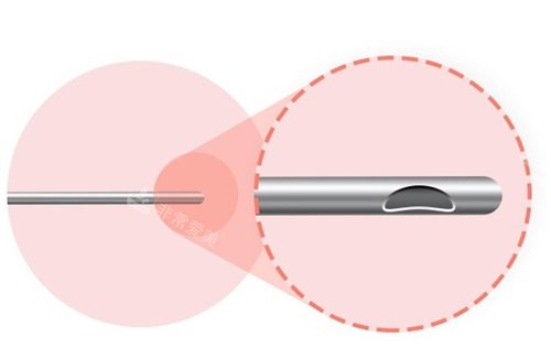 韩国绮林整形医院吸脂针头