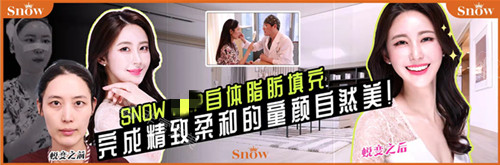 面部自體脂肪填充親身經(jīng)歷照 面部自體脂肪填充親身經(jīng)歷照