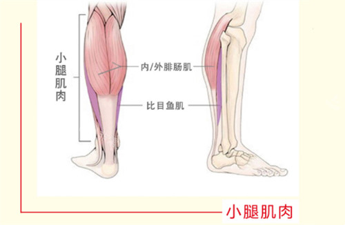 小腿肌肉粗壮原因图示