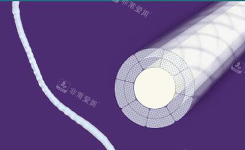 韓國(guó)秀美顏整形外科埋線提升材料特點(diǎn)展示 韓國(guó)秀美顏整形外科埋線提升材料特點(diǎn)展示