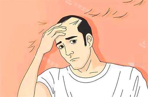 合肥源森植发医院植发漫画图 合肥源森植发医院植发漫画图