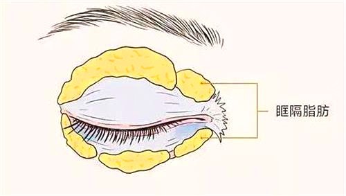 烏魯木齊伊麗莎白醫(yī)院眼部整形圖