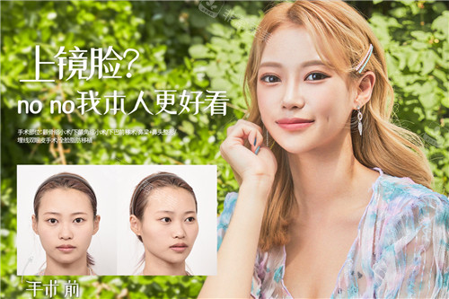 韓國(guó)GNG整形官網(wǎng)真人例子 韓國(guó)GNG整形官網(wǎng)真人例子