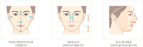 韩国德嘉整形外科隆鼻特点解析图