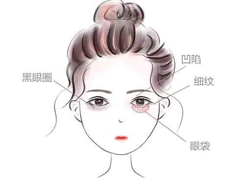 乌鲁木齐美迩美整形医院眼部整形图