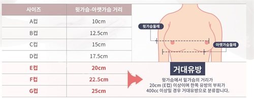 韩国绮林整形医院巨乳症自我诊断标准