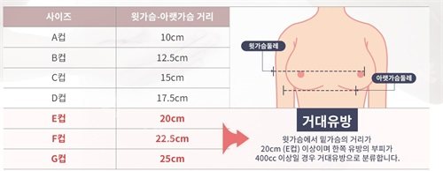 韓國綺林整形醫(yī)院巨乳癥自我診斷標準