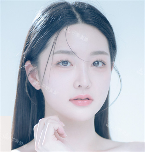 韓國GNG整形醫(yī)院眼部整形術(shù)后照片 韓國GNG整形醫(yī)院眼部整形術(shù)后照片