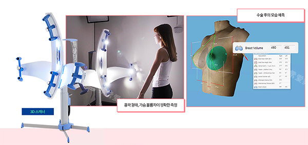 韩国胸部术前设计假体仪器