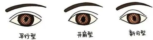 不同類型的雙眼皮 不同類型的雙眼皮