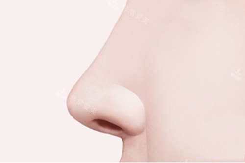 鼻部手术宣传图