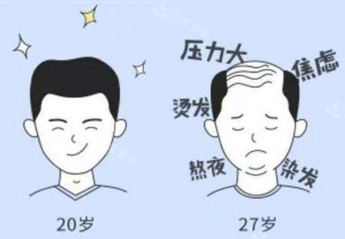 植發(fā)卡通圖 植發(fā)卡通圖