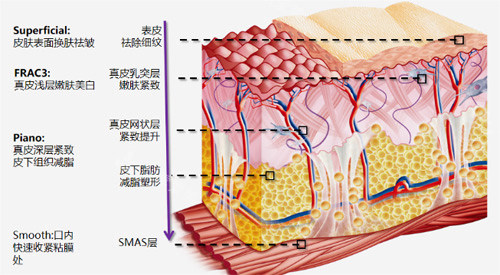 皮膚層次示意圖 皮膚層次示意圖