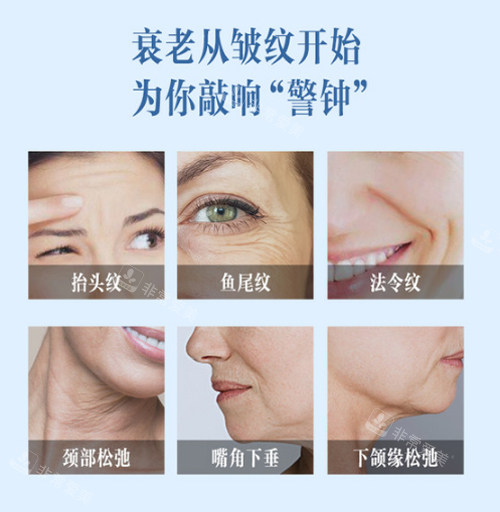 衰老的癥狀 衰老的癥狀