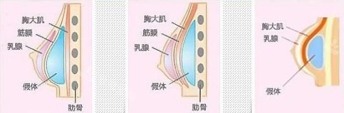 胸部结构示意图