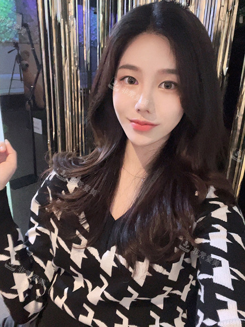 韩国乐日整形鼻修复手术后一个月 韩国乐日整形鼻修复手术后一个月
