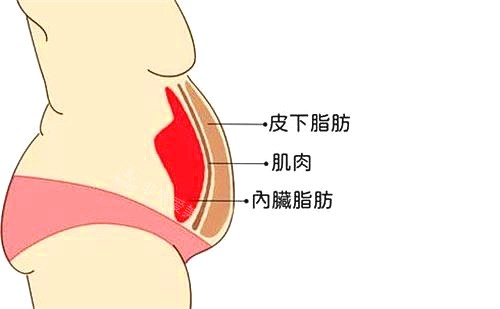 新疆整形医院腹部吸脂术后图