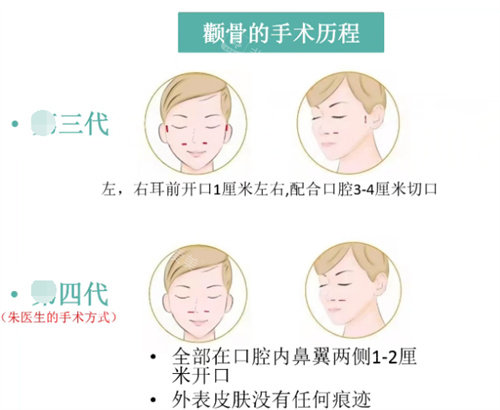 成都西部中西醫(yī)結(jié)合磨骨醫(yī)院的朱樂林醫(yī)生磨骨特色 成都西部中西醫(yī)結(jié)合磨骨醫(yī)院的朱樂林醫(yī)生磨骨特色