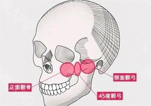 頜面卡通圖 頜面卡通圖
