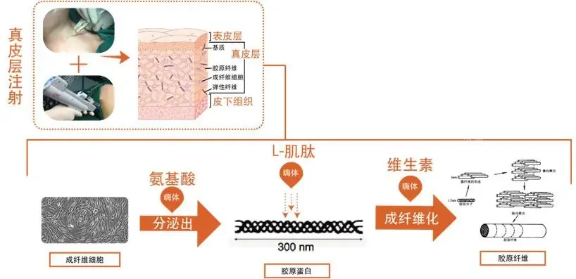 嗨体真皮层注射转化流程