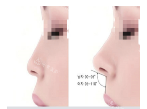 韩国温度整形外科轮廓定制鼻+人中鼻整形,秒懂啥叫相见恨晚