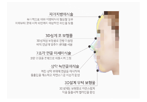 鼻子和額頭下巴線條美學(xué)圖示