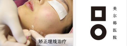 韓國美爾韓醫(yī)院矯正埋線治療 韓國美爾韓醫(yī)院矯正埋線治療