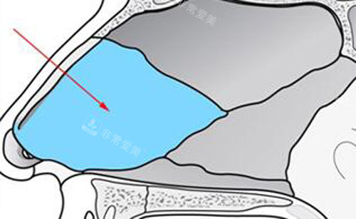 韓國(guó)NJH盧鐘勛整形隆鼻軟骨部位示意圖