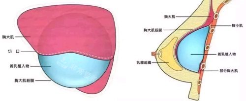 胸部结构示意图 胸部结构示意图