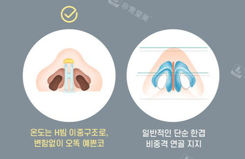 鼻子整形设计标准图示